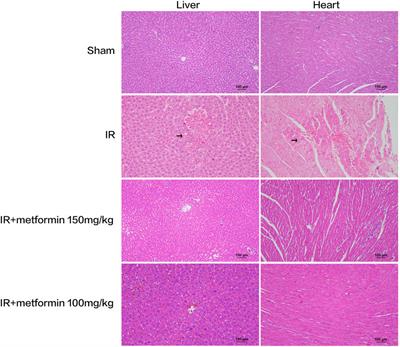 Effect of Metformin on Myocardial Injury Induced by Hepatic Ischemia-Reperfusion in Rats